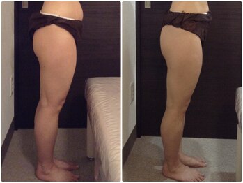 美容整体 ウェリナ 蟹江院/小顔矯正/骨盤矯正/美脚サロン