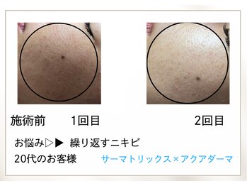 リル(Rire)/Before→After