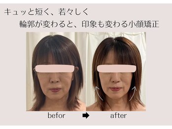 オリナサツキ(OlinaSatsuki)