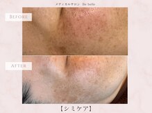 ビベル 八木店(Bebelle)/６回