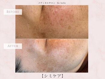 ビベル 八木店(Bebelle)/6回