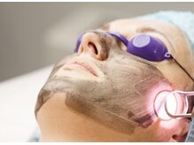 シエル(Ciel)/専門特化！カーボントーニング