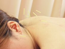 アスカ鍼灸治療院/鍼灸