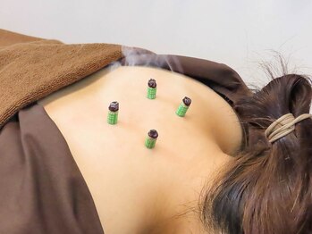 リリーフ治療院(Relief治療院)/お灸