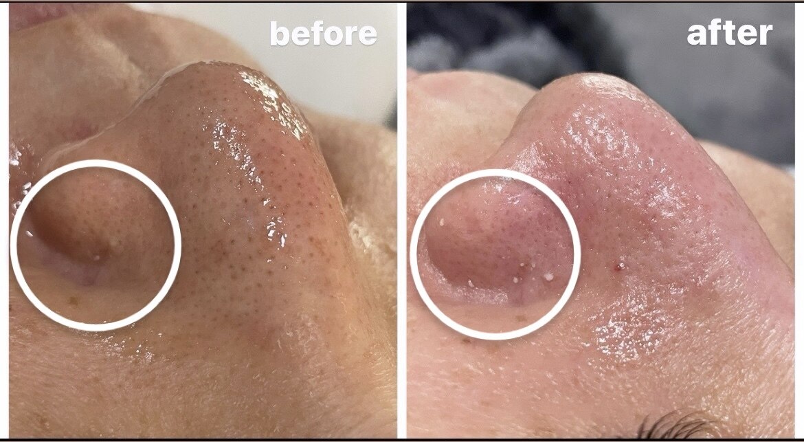 オーロラ 福岡行橋(AURORA)｜ホットペッパービューティー