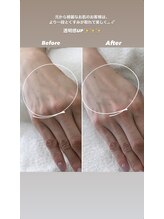 シーオングル(Siii ongle)/泡パック