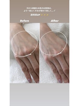 シーオングル(Siii ongle)/泡パック