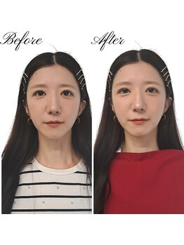 チャヨン(chayeon)/パーソナルカラー診断/川口/浦和