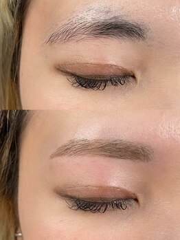 クリスタランイースト(Cristallin East)の写真/美容に精通したプロが担当！実力派サロン★美容効果を即実感◎丁寧で手早い施術が魅力♪