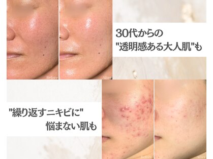 スリースリー(THREE THREE)の写真