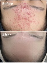 スハダビ110(suhadabi110)/before　after