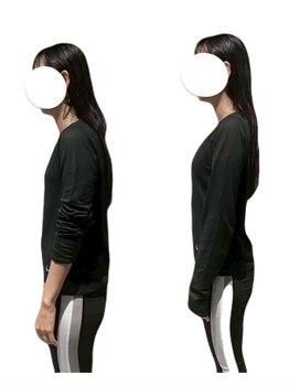 フレックスジム 渋谷店(Flex GYM)/Before/After