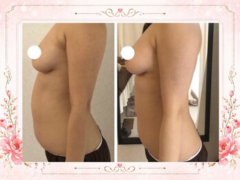 リリ(RILI)/【ダイエット・バストケア】