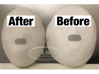 美極 トータルビューティー(美極 TOTAL BEAUTY)/恵比寿/小顔コルギ/エステ/