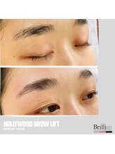 ブリリアン/下向き眉毛を上向に改善