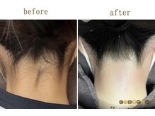 フー(woo)/うなじワックス