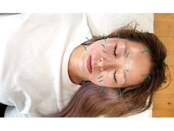 内山鍼灸マッサージ治療院