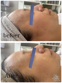 リッチベル(richbelle)/