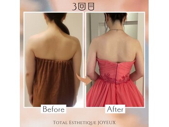 トータルエステティック ジョワイユ(JOYEUX)/ブライダルも全身ケア