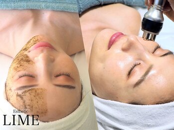 ライム 川崎(LIME)/ハーブピーリング×ラジオ波