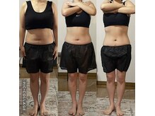 施術4回でマイナス5kg。腸が上がりデトックス出来る身体に。