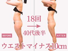 べモーレ 上本町 谷町九丁目(Bemolle)/40代痩身18回ビフォーアフター☆