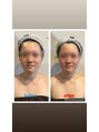 小顔フェイスラボ 岐阜店(小顔 Face Labo)&nbsp;コルギは１回でも効果が分かるのぜひお気軽にお越しください！