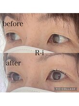 アールアイ(R-i)/アイリッドアップパーマ