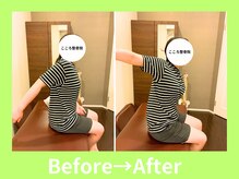 こころ整骨院/30代女性のビフォーアフター