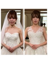 ルビー 池袋店(Ruby)/ブライダル前の小顔矯正