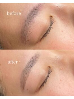 オージェイプラス(OJ+)/ハリウッドブロウリフト