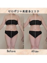 ラエッセス(A Laessess)/１回でも変化あり