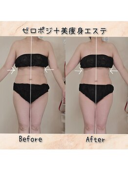 ラエッセス(A Laessess)/１回でも変化あり