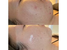 ラドンナ(LA DONNA)/トラブル知らずの肌へ