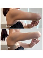 エヌア(nA)/2ヶ月プラン♪20代痩身全身！