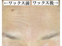 ♯しわ　♯美白　♯顔脱毛　♯ワックス　♯脱毛　♯黒ずみ