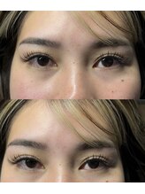 ハウオリ(hau’oli)/LEDバインドロック140束