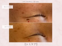 ビベル 八木店(Bebelle)/６回