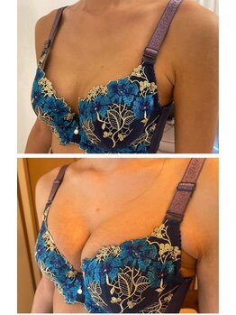 美人バスト 豊橋店/バストアップ症例【バストケア】