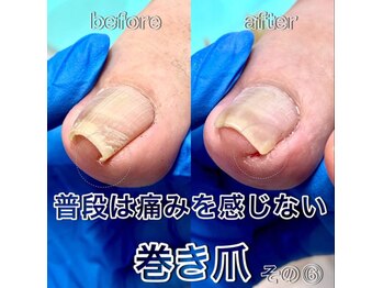 新宿巻き爪補正店/