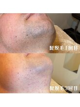 アルト(ALTO)/リピーター様