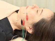 はりきゅう花桃/食いしばり・エラはり特化美容鍼