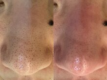 サイセイ(SAISEI)/