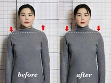 プーラビタ(PURAVITA)/播磨町　姿勢改善　before after