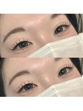 リグ(LIG)/フラットラッシュ100本