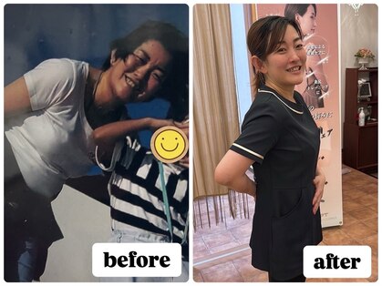 ツボミ(TSUBOMI)の写真