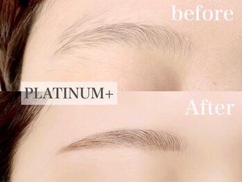 アイビューティーワンド(Eye Beauty WAND)の写真/アイブロウWAX脱毛で気になる眉毛のお悩みもしっかり解消♪お得なクーポンも多数ご用意◎
