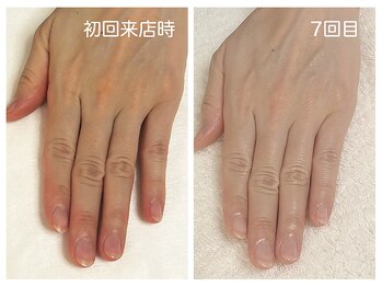キレイテ 上野店/50代/7回目【ハンドケア上野】