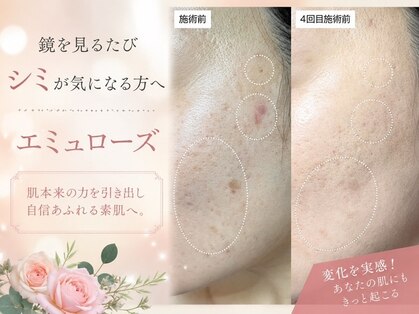 エミュローズ 段原店(Nm' Rose)の写真