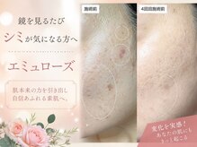 エミュローズ 段原店(Nm' Rose)